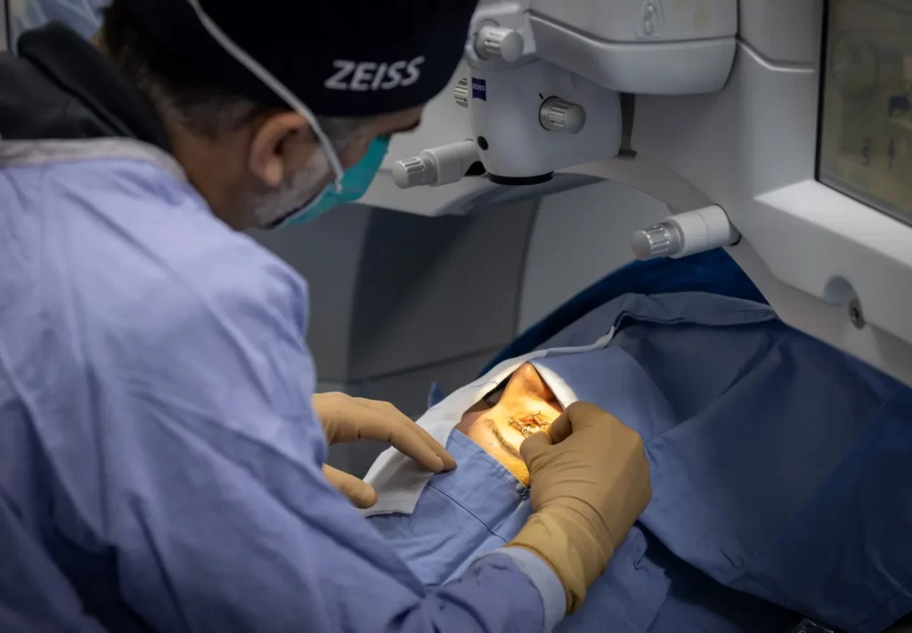 Cirugía SMILE para corregir miopía y astigmatismo mediante tecnología láser de alta precisión.